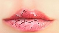 Bibir Kering Saat Puasa? Berikut Tipsnya Agar Tetap Lembab dan Sehat
