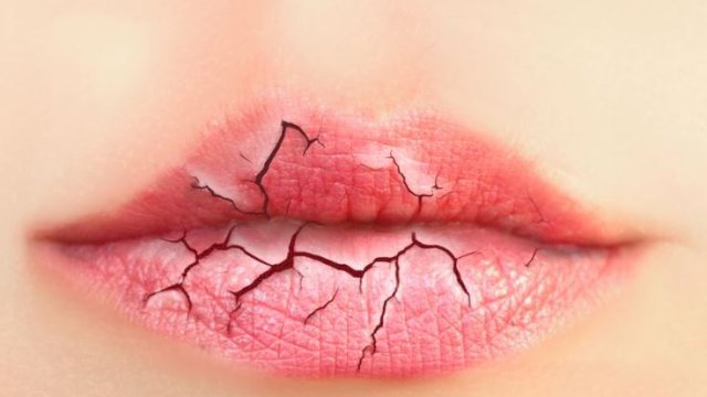 Ilustrasi. (Foto: Shutterstock)