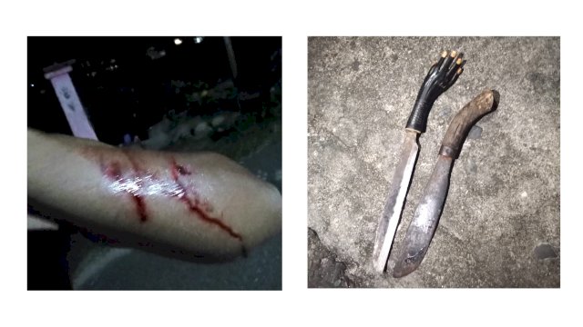 Tangan korban Rikki yang terkena sabetan parang (kiri). Barang bukti parang yang digunakan pelaku (kanan)